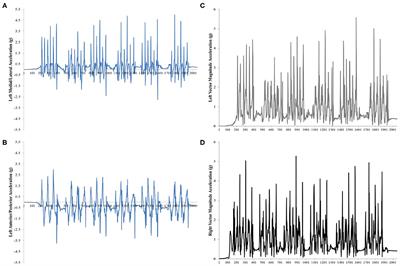 Validation of Accelerometry Data to Identify Movement Patterns During Agility Testing